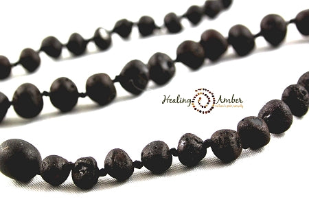 Healing Amber Jewelry 🇨🇦