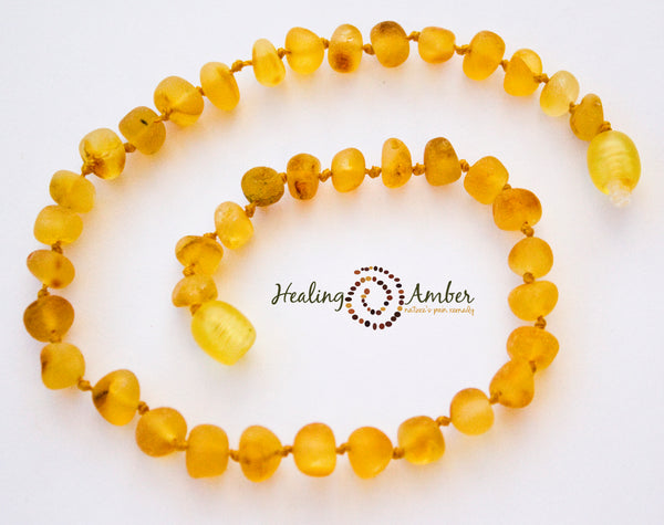 Healing Amber Jewelry 🇨🇦